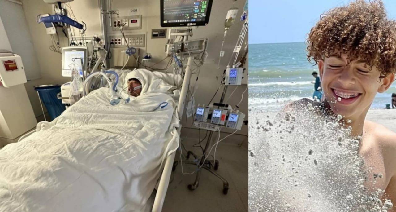  Por un reto de TikTok, un joven resultó con el 80 por ciento del cuerpo quemado